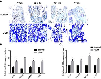 miR-199a Is Upregulated in GDM Targeting the MeCP2-Trpc3 Pathway